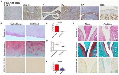 Roles and Mechanisms of Irisin in Attenuating Pathological Features of Osteoarthritis